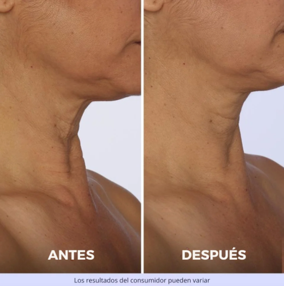 Crema Reafirmante de Cuello