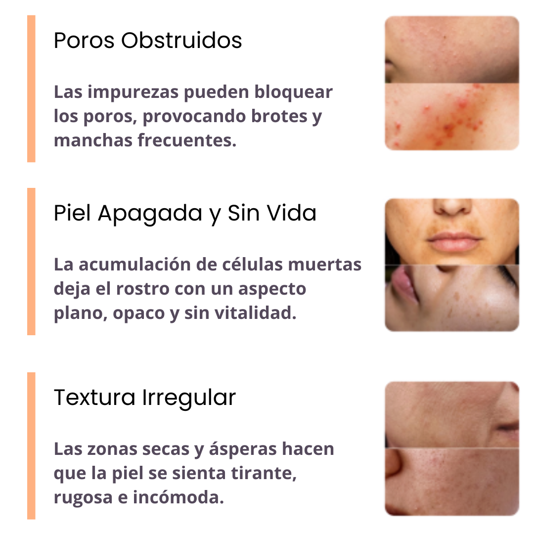 LANINCARE PRO® + SERUM FACIAL (GRATIS)